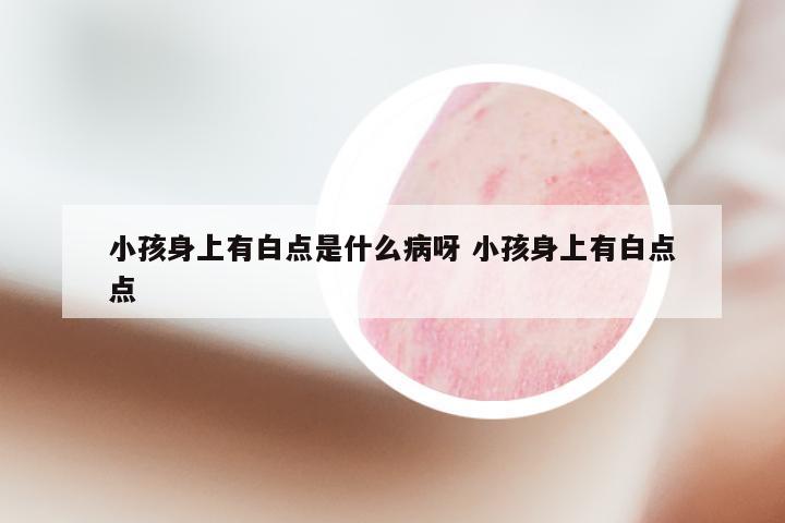 小孩身上有白点是什么病呀 小孩身上有白点点
