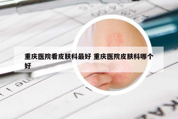 重庆医院看皮肤科最好 重庆医院皮肤科哪个好