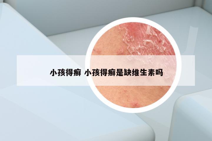 小孩得癣 小孩得癣是缺维生素吗
