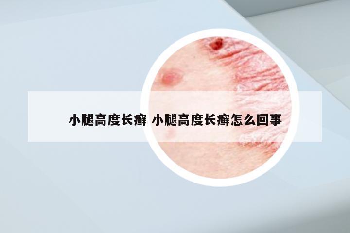小腿高度长癣 小腿高度长癣怎么回事