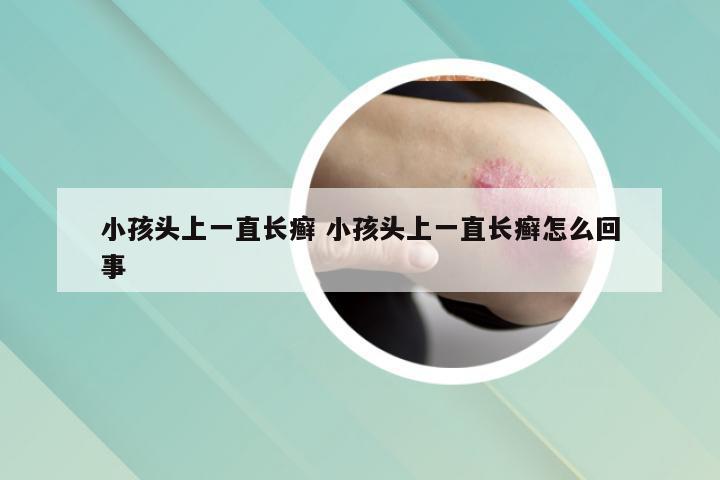 小孩头上一直长癣 小孩头上一直长癣怎么回事