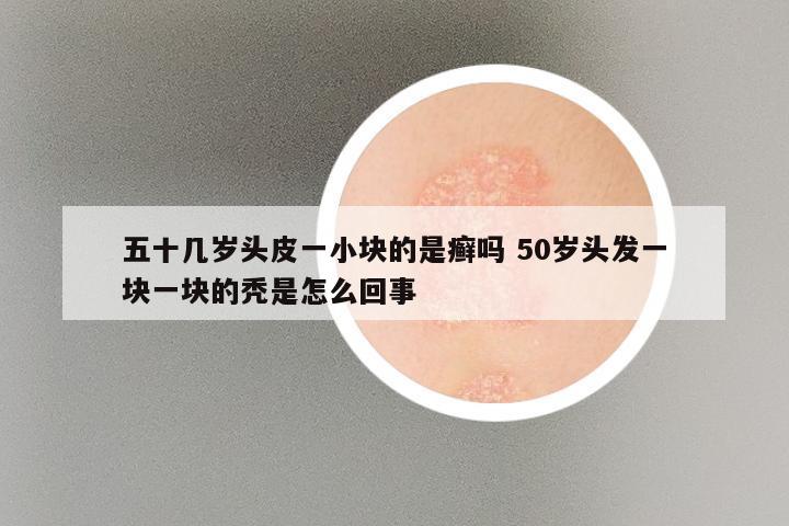 五十几岁头皮一小块的是癣吗 50岁头发一块一块的秃是怎么回事