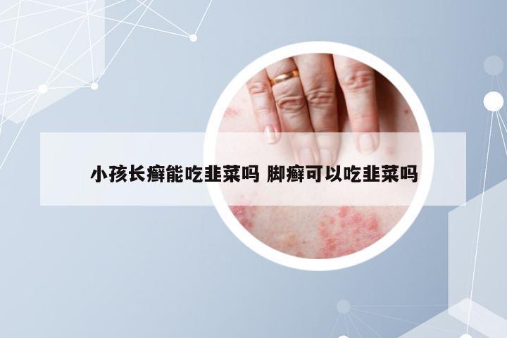 小孩长癣能吃韭菜吗 脚癣可以吃韭菜吗