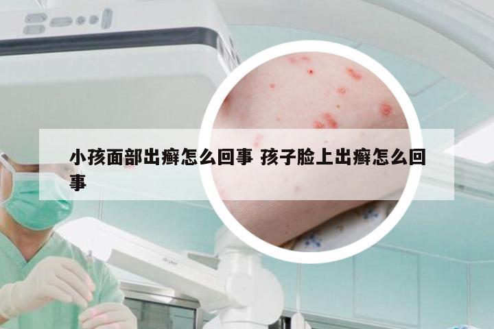 小孩面部出癣怎么回事 孩子脸上出癣怎么回事
