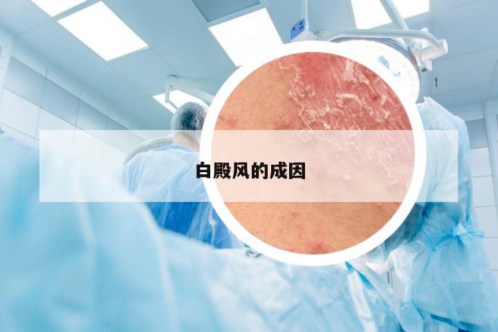 白殿风的成因