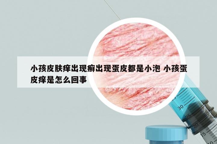 小孩皮肤痒出现癣出现蛋皮都是小泡 小孩蛋皮痒是怎么回事