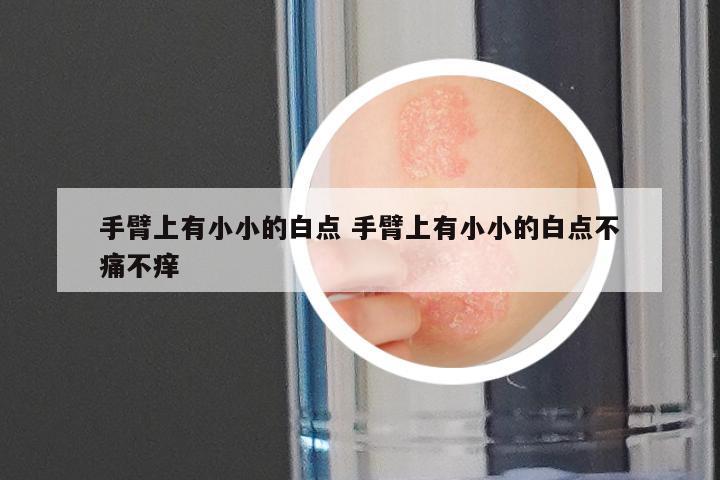 手臂上有小小的白点 手臂上有小小的白点不痛不痒