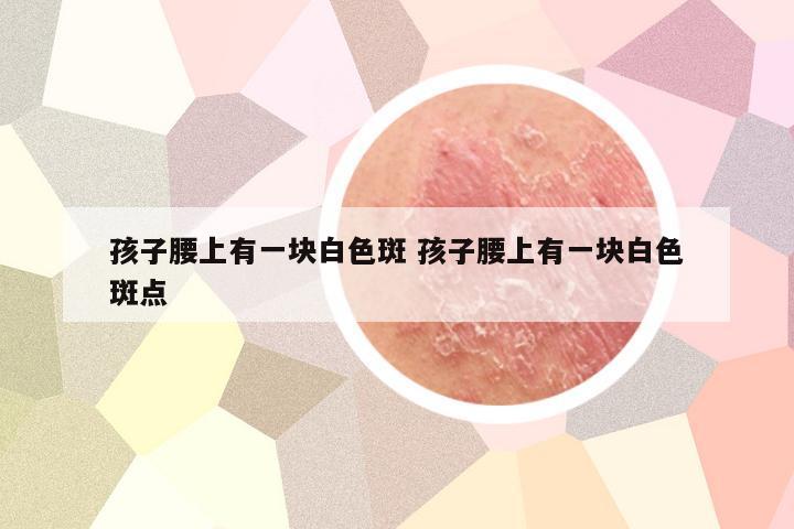 孩子腰上有一块白色斑 孩子腰上有一块白色斑点