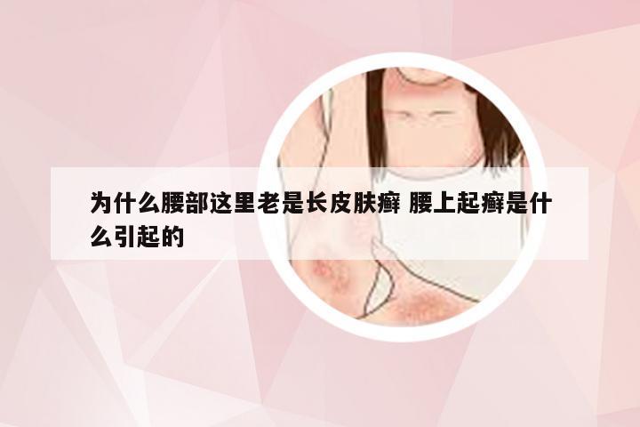 为什么腰部这里老是长皮肤癣 腰上起癣是什么引起的