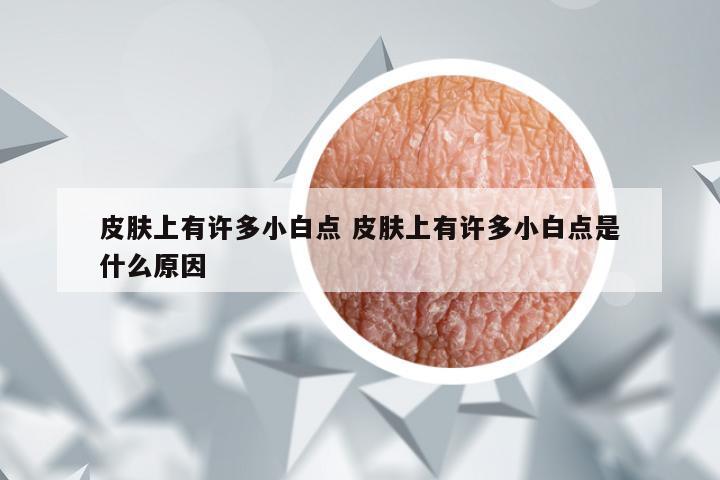 皮肤上有许多小白点 皮肤上有许多小白点是什么原因
