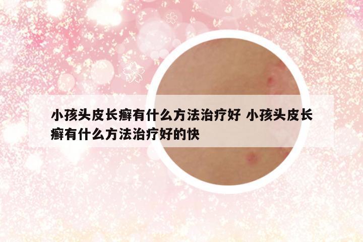 小孩头皮长癣有什么方法治疗好 小孩头皮长癣有什么方法治疗好的快
