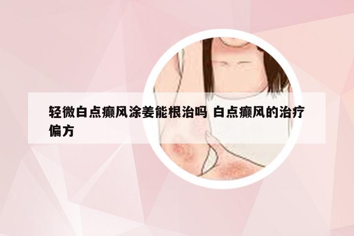 轻微白点癫风涂姜能根治吗 白点癫风的治疗偏方