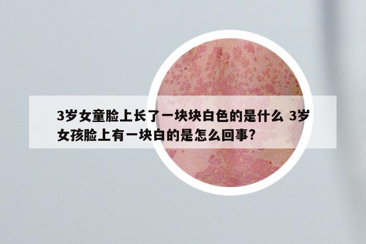 3岁女童脸上长了一块块白色的是什么 3岁女孩脸上有一块白的是怎么回事?