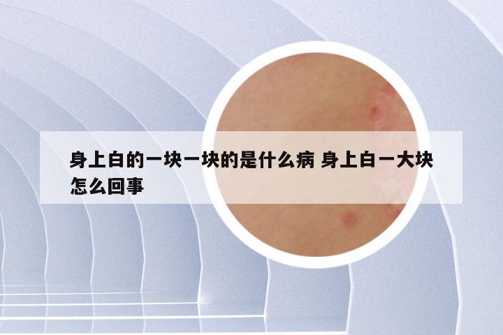 身上白的一块一块的是什么病 身上白一大块怎么回事
