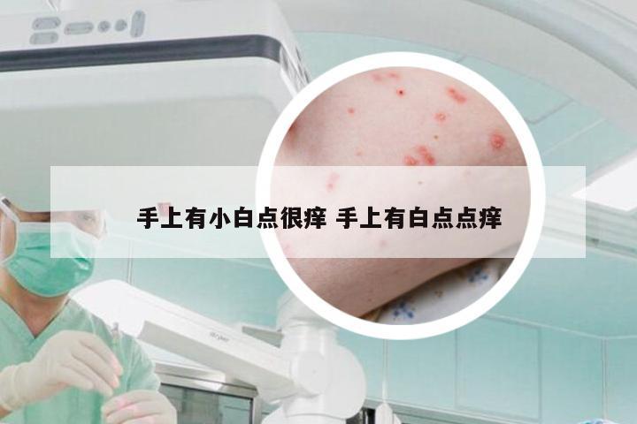 手上有小白点很痒 手上有白点点痒