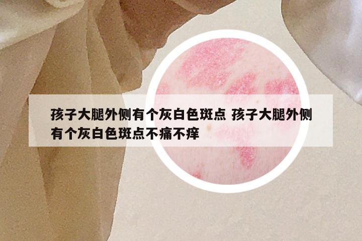 孩子大腿外侧有个灰白色斑点 孩子大腿外侧有个灰白色斑点不痛不痒