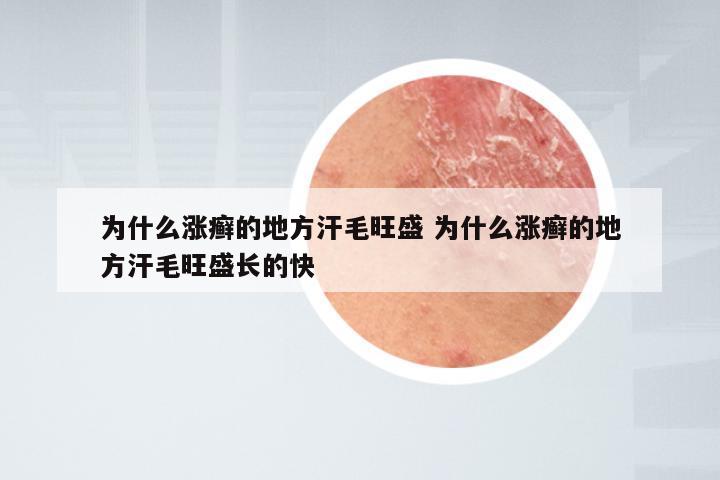 为什么涨癣的地方汗毛旺盛 为什么涨癣的地方汗毛旺盛长的快