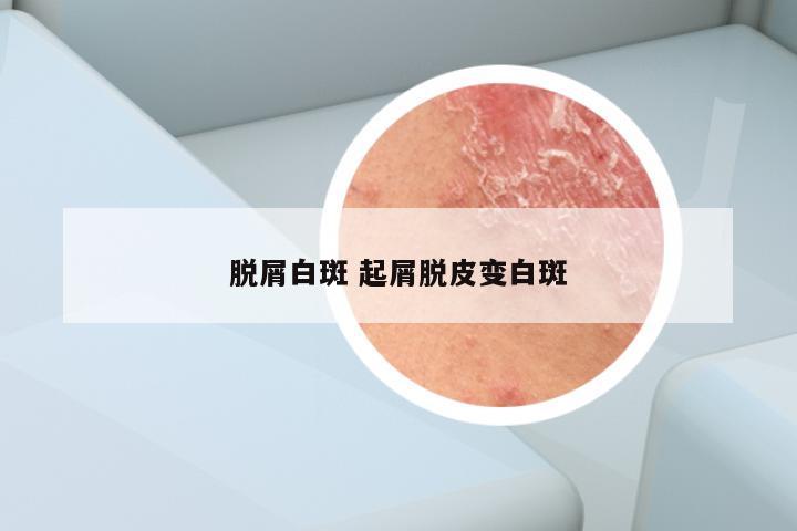 脱屑白斑 起屑脱皮变白斑