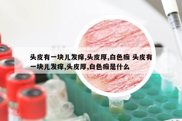 头皮有一块儿发痒,头皮厚,白色痂 头皮有一块儿发痒,头皮厚,白色痂是什么