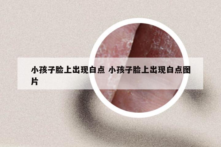 小孩子脸上出现白点 小孩子脸上出现白点图片
