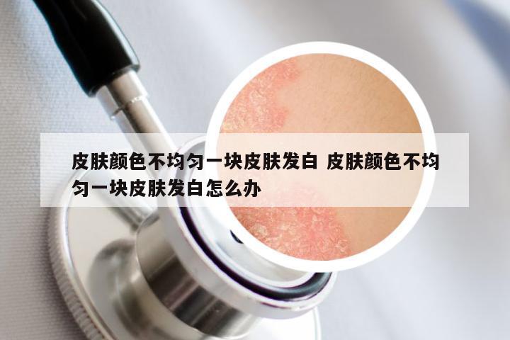 皮肤颜色不均匀一块皮肤发白 皮肤颜色不均匀一块皮肤发白怎么办