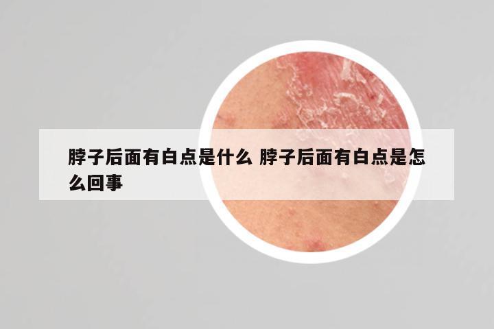 脖子后面有白点是什么 脖子后面有白点是怎么回事