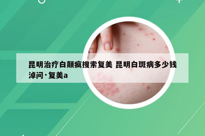 昆明治疗白颠疯搜索复美 昆明白斑病多少钱淖问·复美a