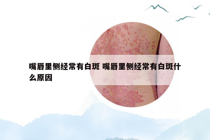 嘴唇里侧经常有白斑 嘴唇里侧经常有白斑什么原因