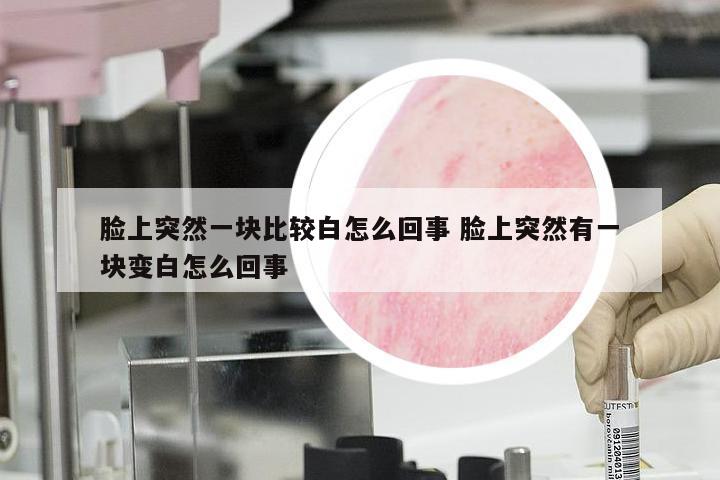 脸上突然一块比较白怎么回事 脸上突然有一块变白怎么回事