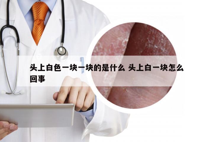 头上白色一块一块的是什么 头上白一块怎么回事