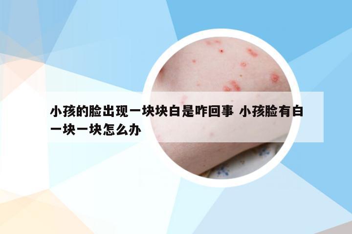 小孩的脸出现一块块白是咋回事 小孩脸有白一块一块怎么办