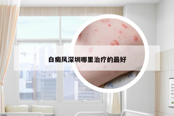 白癜风深圳哪里治疗的最好