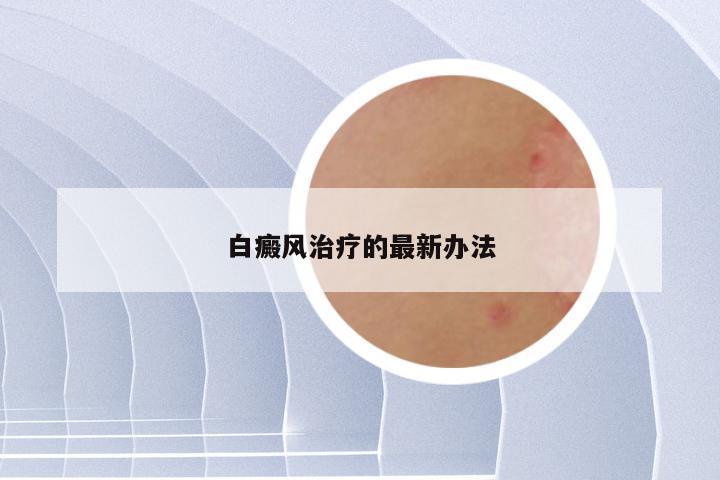 白癜风治疗的最新办法