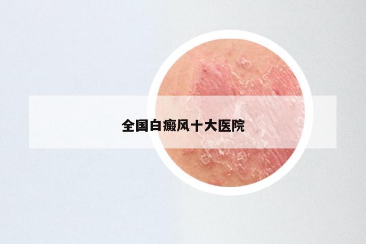 全国白癜风十大医院