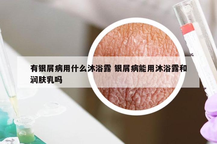 有银屑病用什么沐浴露 银屑病能用沐浴露和润肤乳吗
