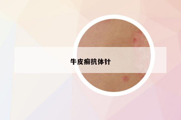 牛皮癣抗体针