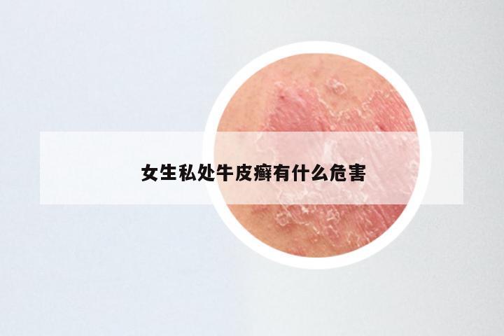 女生私处牛皮癣有什么危害