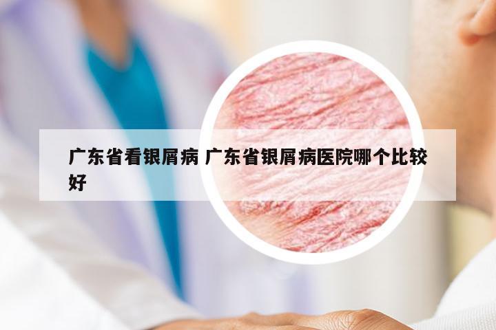 广东省看银屑病 广东省银屑病医院哪个比较好