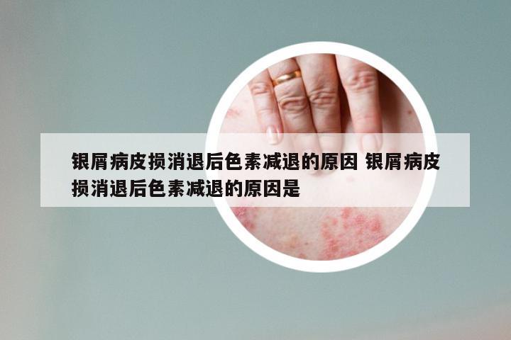 银屑病皮损消退后色素减退的原因 银屑病皮损消退后色素减退的原因是
