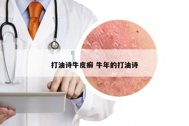 打油诗牛皮癣 牛年的打油诗