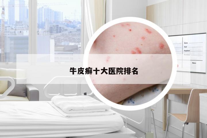 牛皮癣十大医院排名