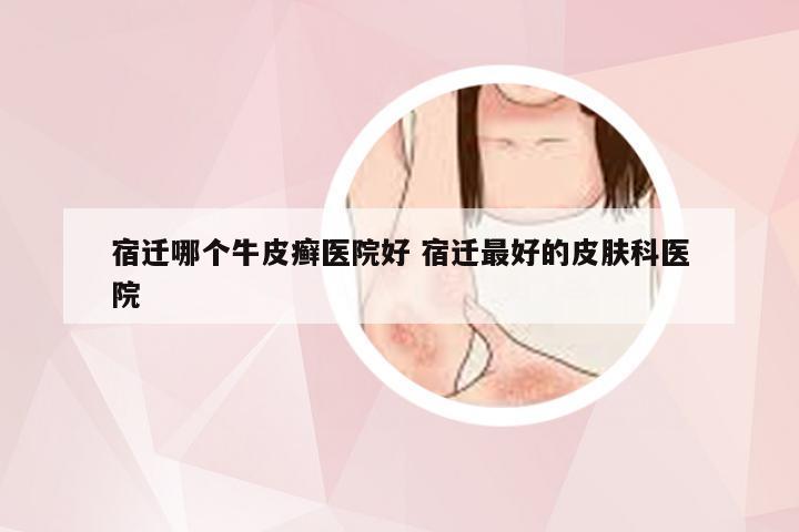 宿迁哪个牛皮癣医院好 宿迁最好的皮肤科医院