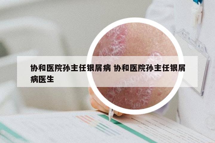 协和医院孙主任银屑病 协和医院孙主任银屑病医生