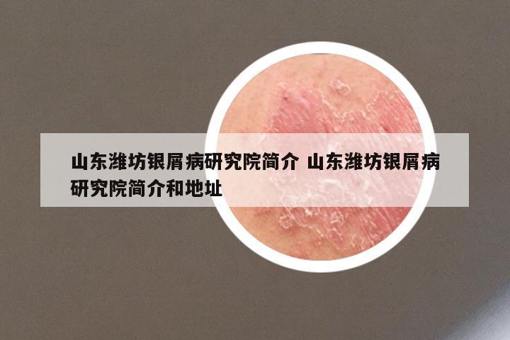 山东潍坊银屑病研究院简介 山东潍坊银屑病研究院简介和地址