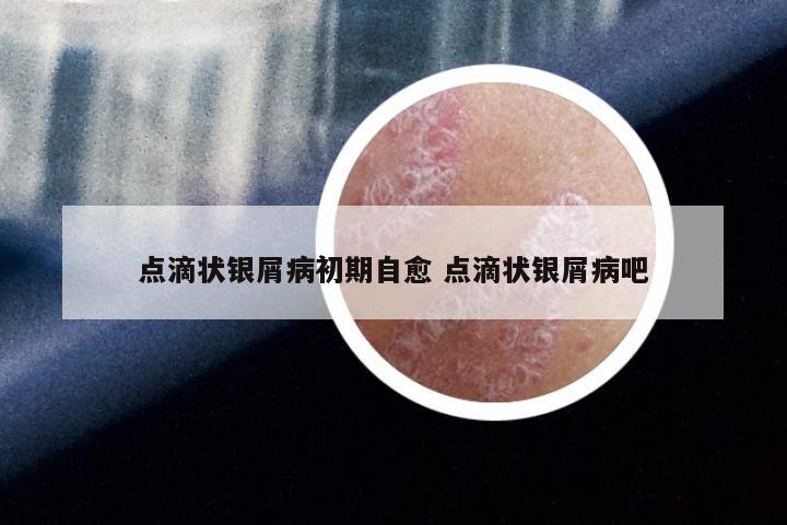 点滴状银屑病初期自愈 点滴状银屑病吧