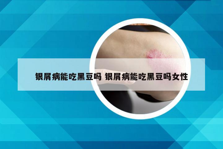 银屑病能吃黑豆吗 银屑病能吃黑豆吗女性