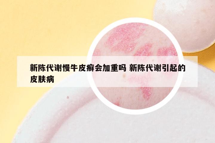 新陈代谢慢牛皮癣会加重吗 新陈代谢引起的皮肤病