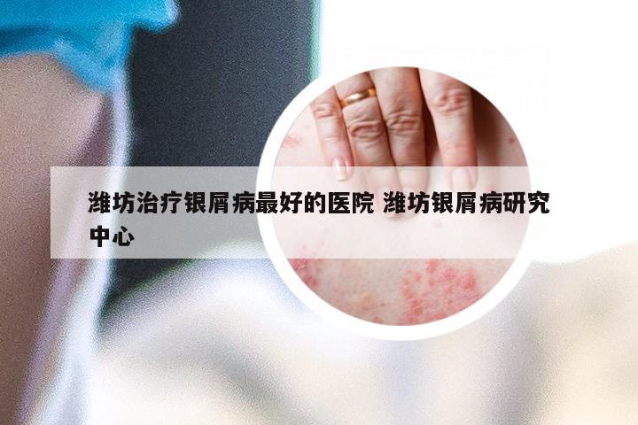 潍坊治疗银屑病最好的医院 潍坊银屑病研究中心