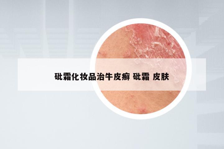 砒霜化妆品治牛皮癣 砒霜 皮肤