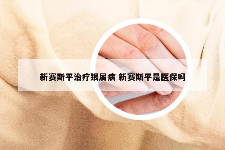 新赛斯平治疗银屑病 新赛斯平是医保吗